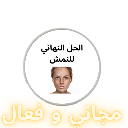 الحل النهائي للنمش