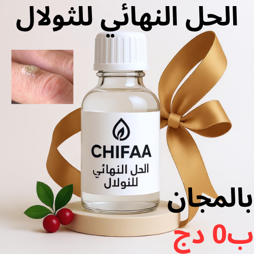 الحل النهائي للثولال