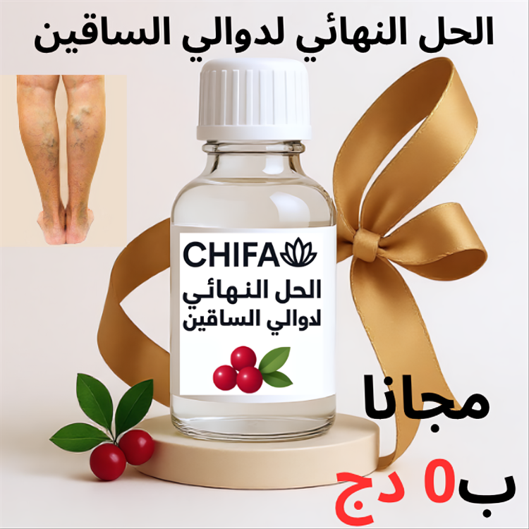 الحل النهائي لدوالي الساقين