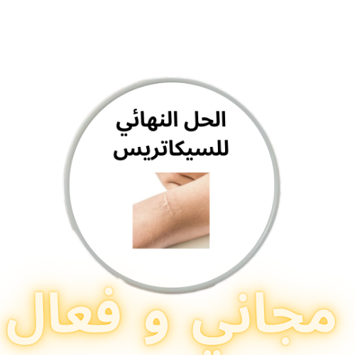 الحل النهائي للسيكاتريس