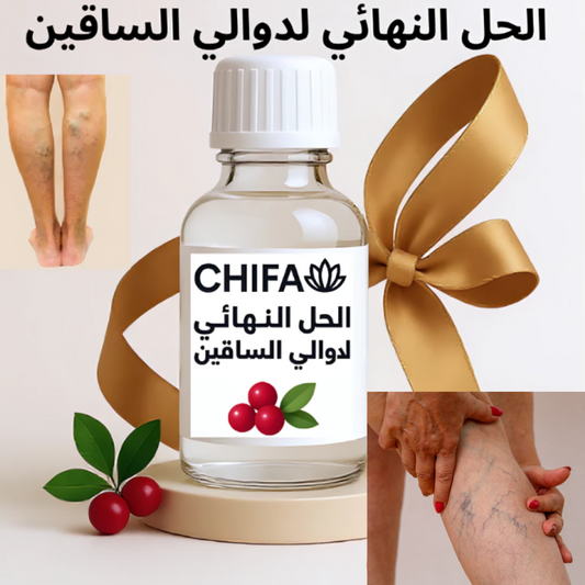 الحل النهائي لدوالي الساقين