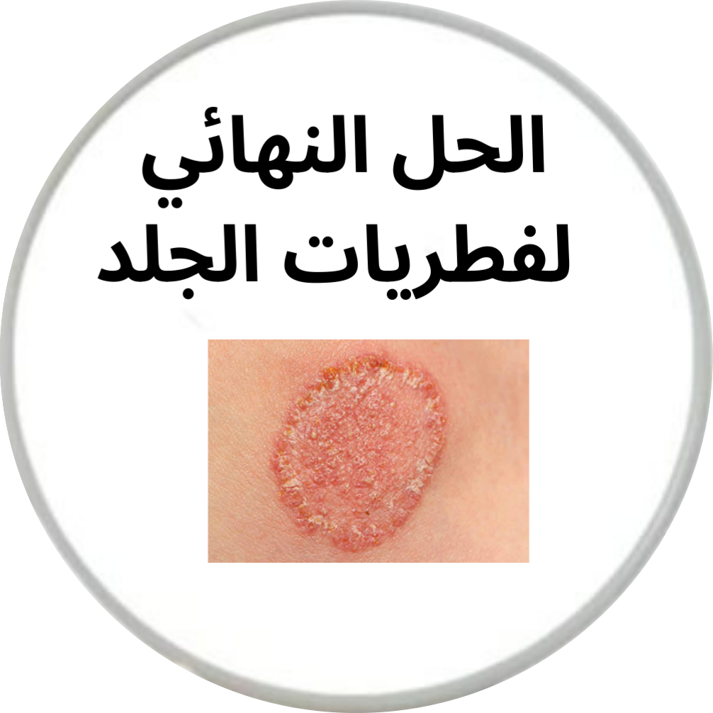 كريم تخلص من فطريات الجلد