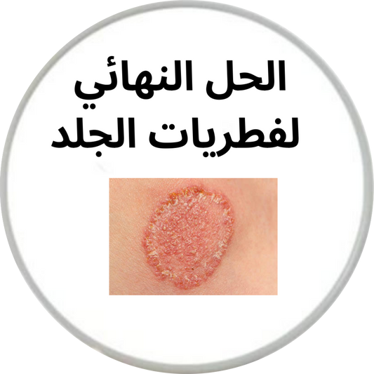 كريم تخلص من فطريات الجلد